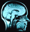 Brain Scan